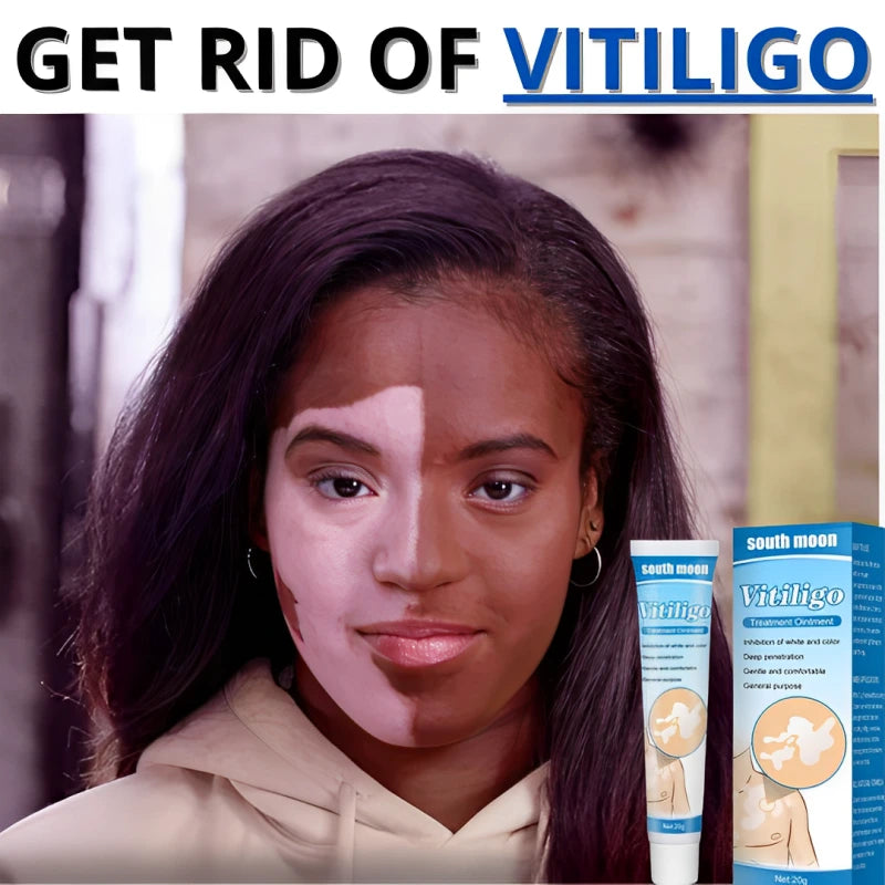 Restore Your Skin's Natural Beauty with Vitiligo Cream