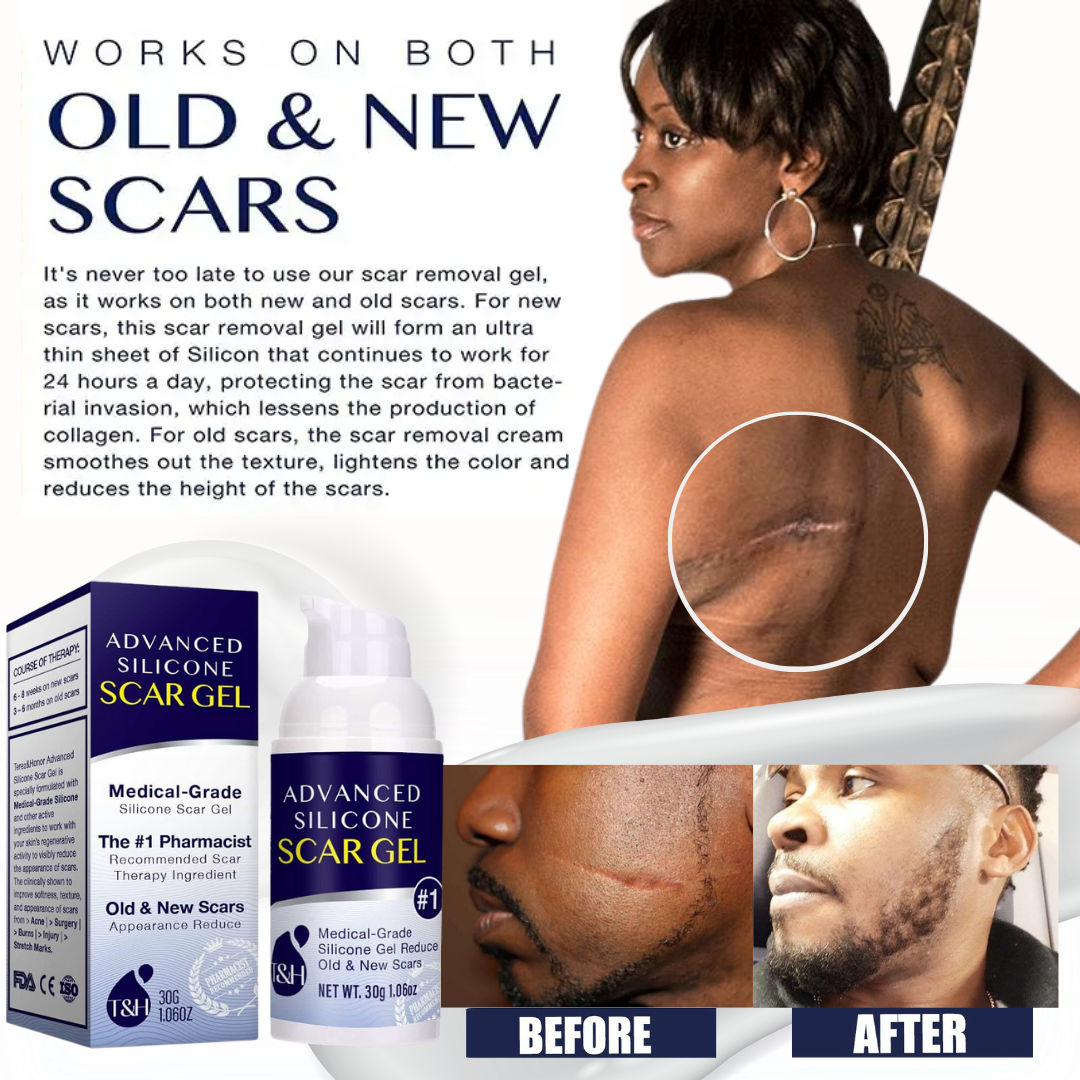 Fade Scars Away with Our Powerful Scar Removal Gel!