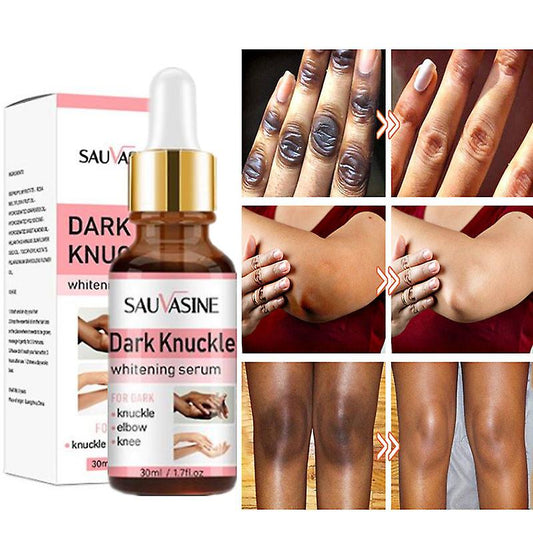 Magic Dark Knuckles Fast Lightening Serum