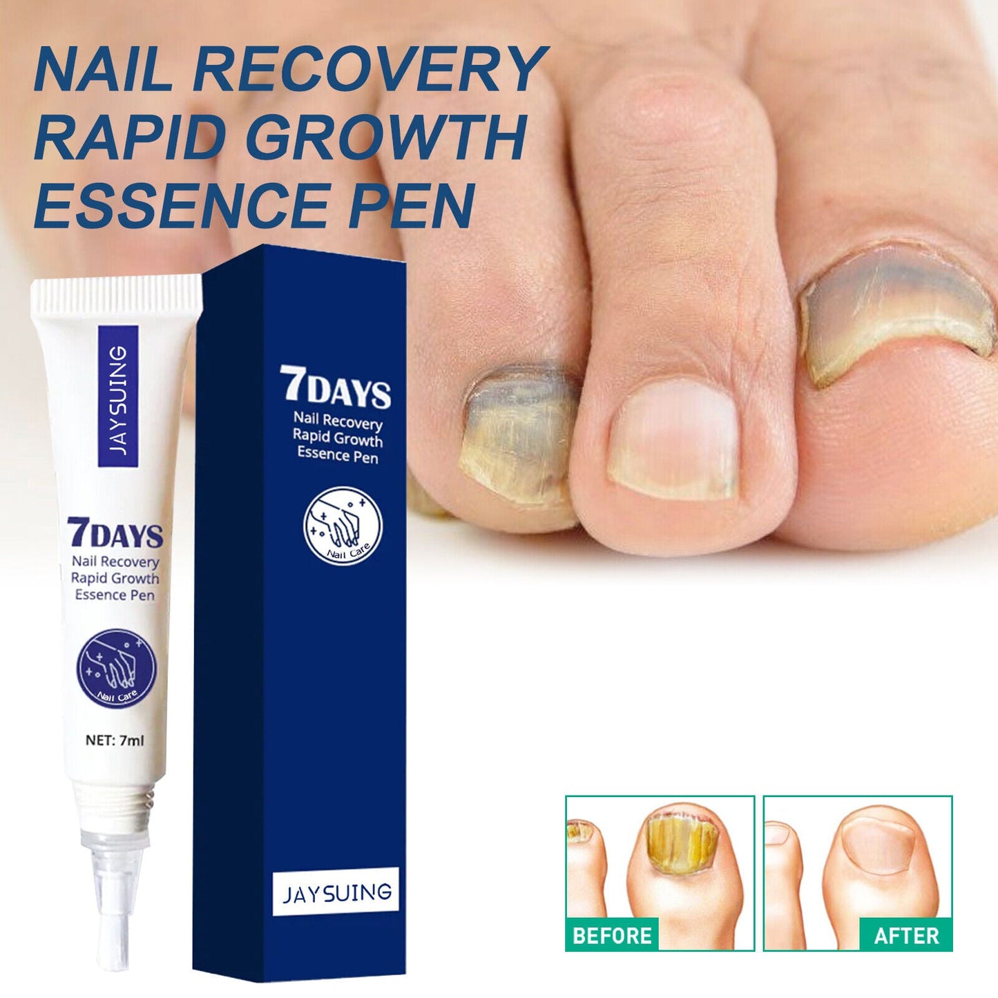 7 Days Nail Recovery Pen